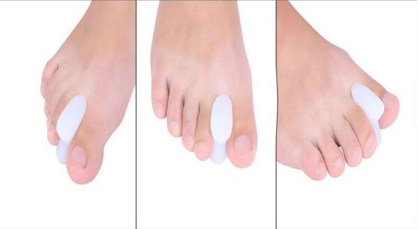 لا انگشتی سیلیکونی هالوکس والگوس نوپا - Image 2