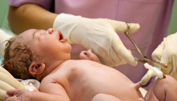 کلمپ بند ناف برند بکر - Image 4